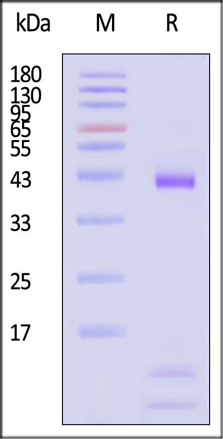 HLA-A*1101 & B2M & KRASG12V (VVVGAVGVGK) SDS-PAGE