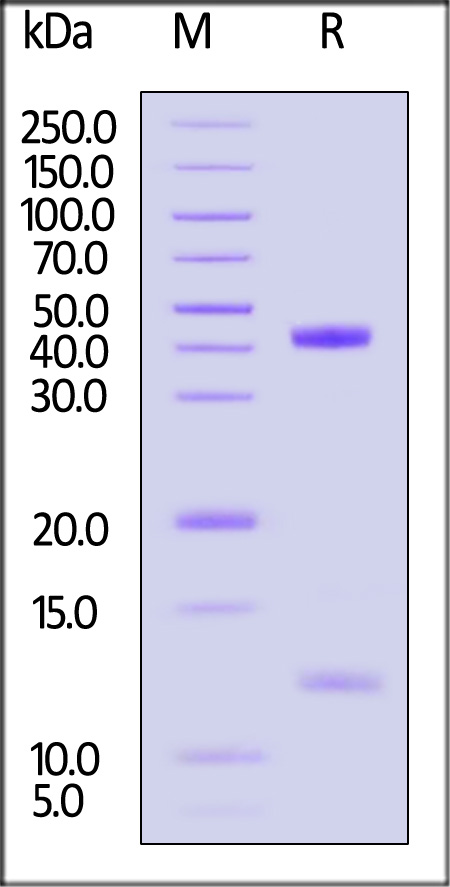 HLA-A*1101 | B2M | KRASG12V (VVGAVGVGK) SDS-PAGE