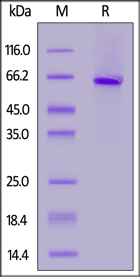 IGFBP-7 SDS-PAGE