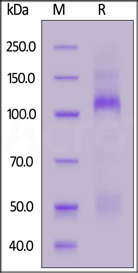 IGF-I R SDS-PAGE