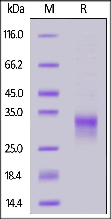 Human IL-29, His Tag (Cat. No. IL9-H4228) SDS-PAGE gel