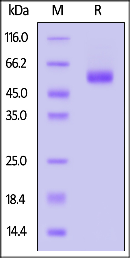 Human IL-18 R beta, His Tag (Cat. No. ILB-H52H8) SDS-PAGE gel