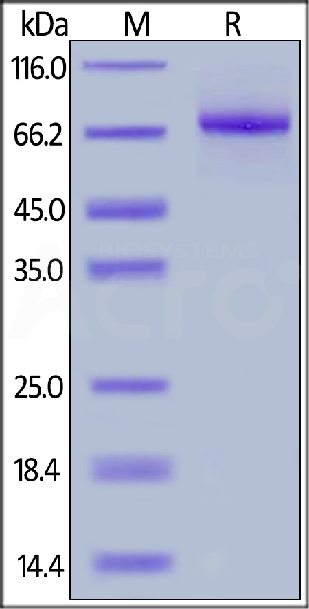 IL-12 R beta 1 SDS-PAGE