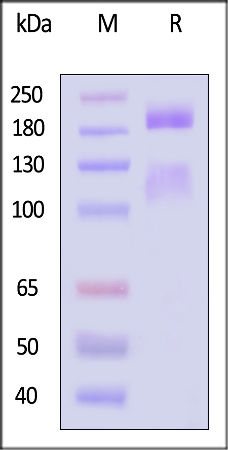 Integrin alpha 1 beta 1 SDS-PAGE