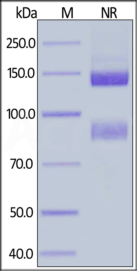 Integrin alpha V beta 5 SDS-PAGE