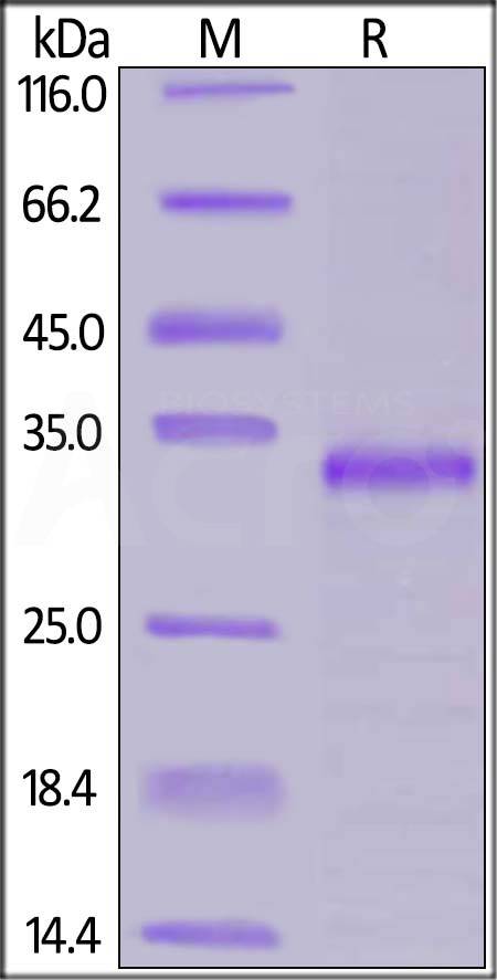 Human JAK1, His Tag (Cat. No. JA1-H5547) SDS-PAGE gel