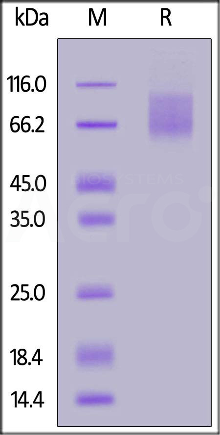 TIM-1 SDS-PAGE