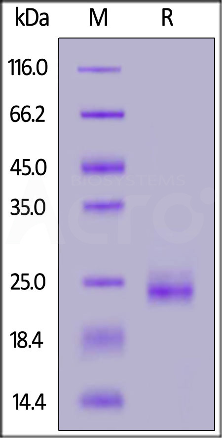 Human KRAS, His Tag (Cat. No. KRS-H5547) SDS-PAGE gel