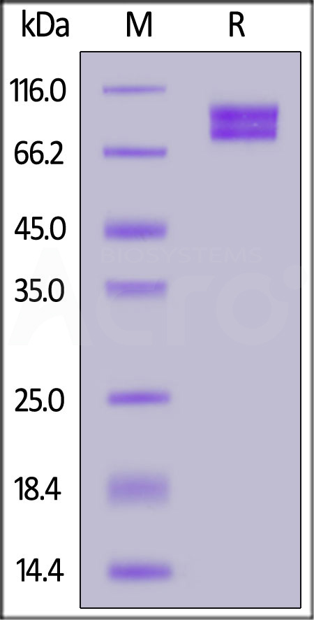 Cynomolgus MCAM, His Tag (Cat. No. MCM-C52H3) SDS-PAGE gel