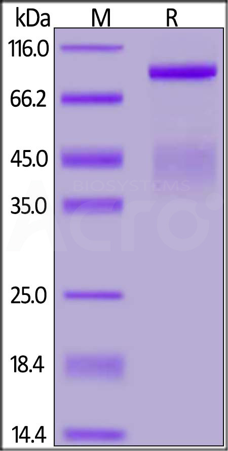 HGF R SDS-PAGE