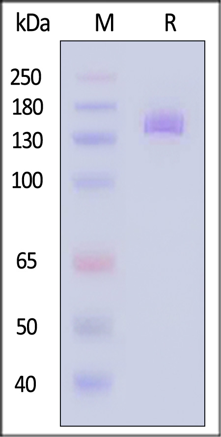 NCAM-1 SDS-PAGE