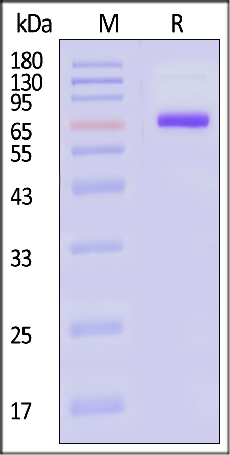 Neuraminidase (NA) SDS-PAGE