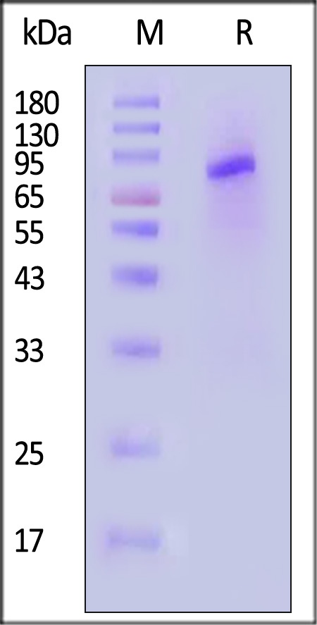 Neuraminidase (NA) SDS-PAGE