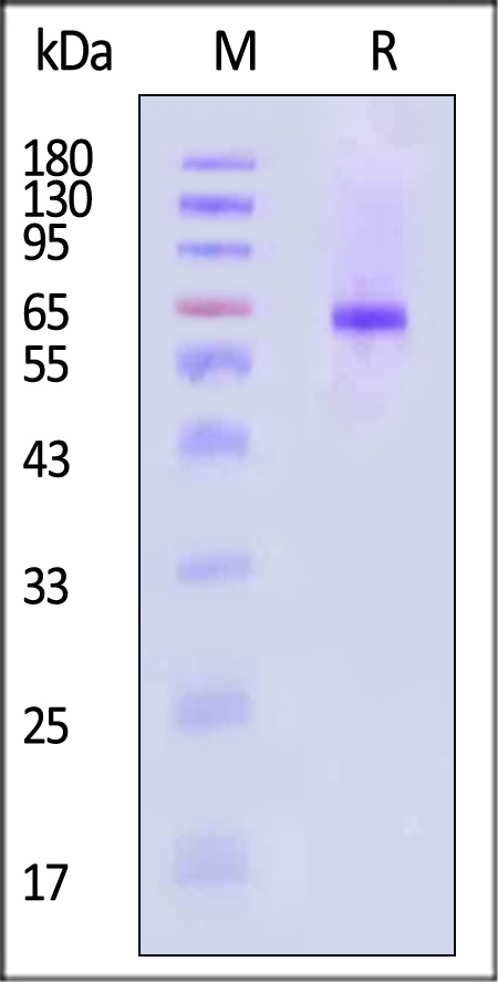 Neuraminidase (NA) SDS-PAGE