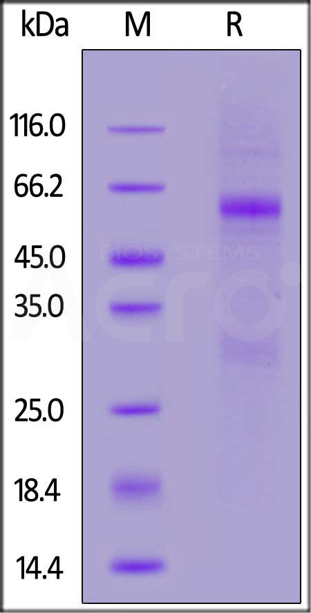 Nucleocapsid protein SDS-PAGE