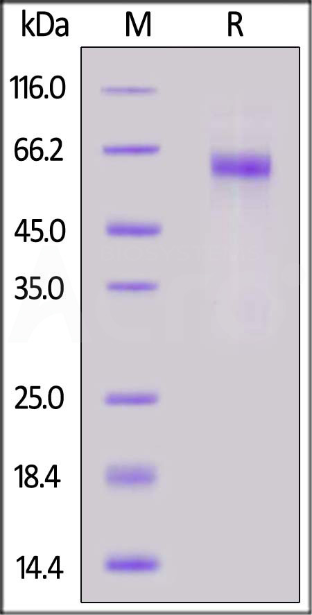 Nucleocapsid protein SDS-PAGE