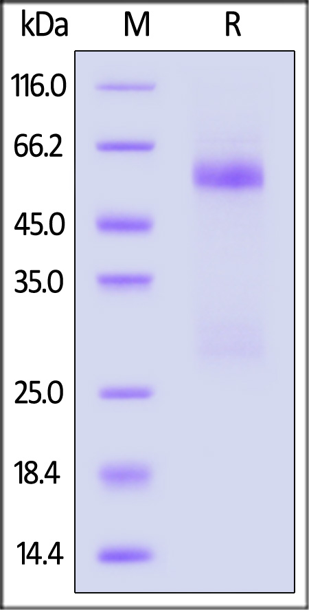 Nucleocapsid protein SDS-PAGE