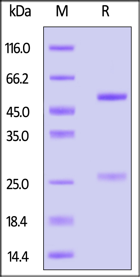 Nucleocapsid protein SDS-PAGE