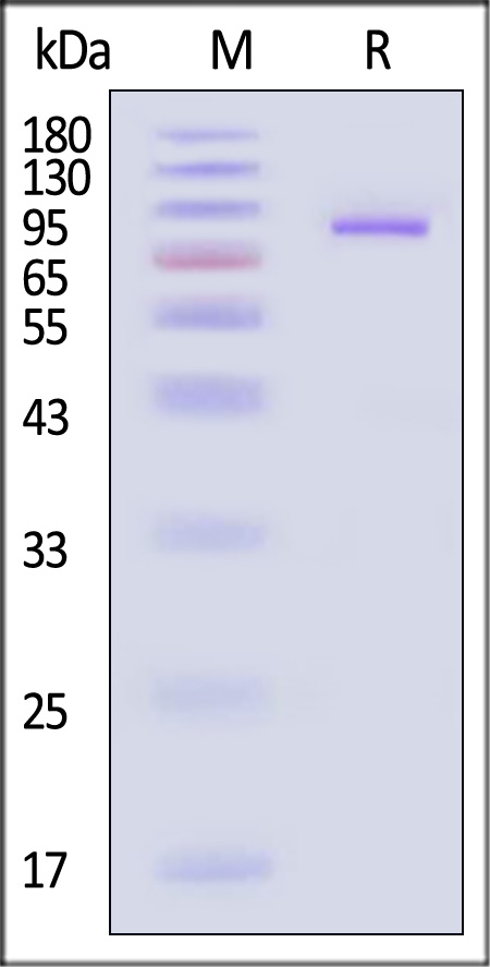 PADI3 SDS-PAGE