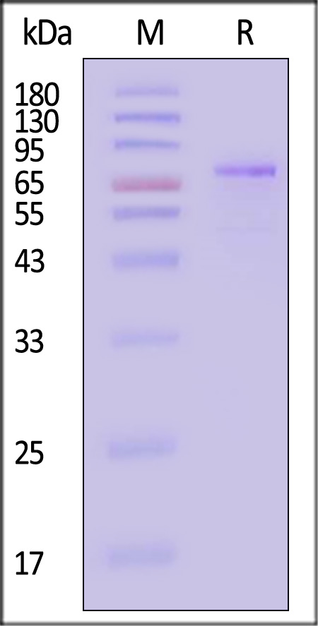 PADI6 SDS-PAGE