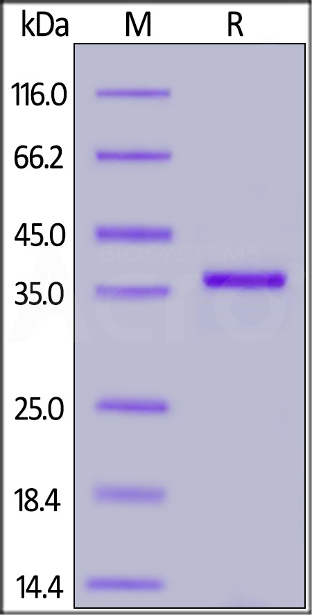 Papain-like Protease SDS-PAGE