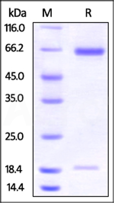 PCSK9 SDS-PAGE