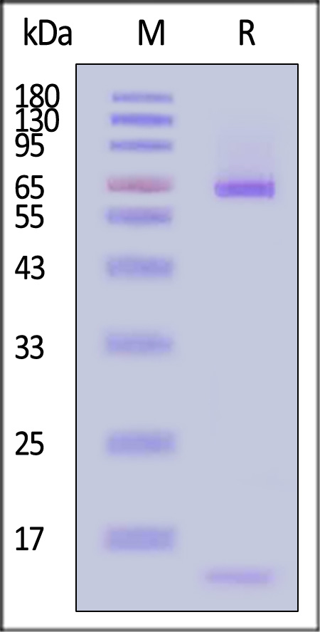 PCSK9 SDS-PAGE