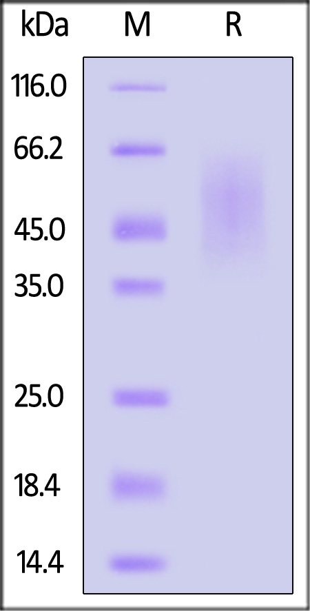 Human Plectin, His Tag (Cat. No. PLN-H5249) SDS-PAGE gel