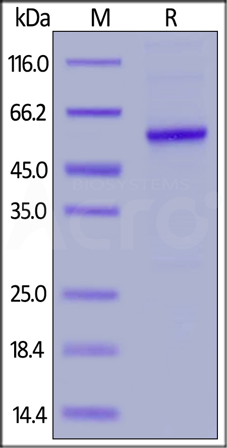 Human Properdin, His Tag (Cat. No. PRN-H52H3) SDS-PAGE gel