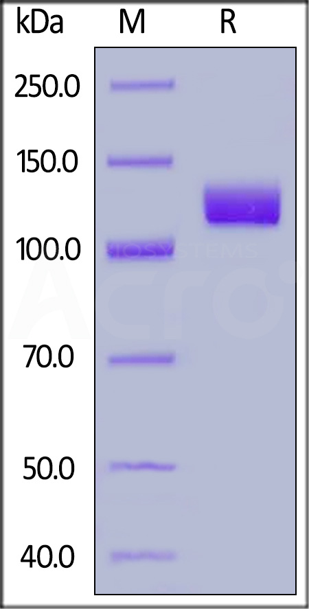 PSMA SDS-PAGE