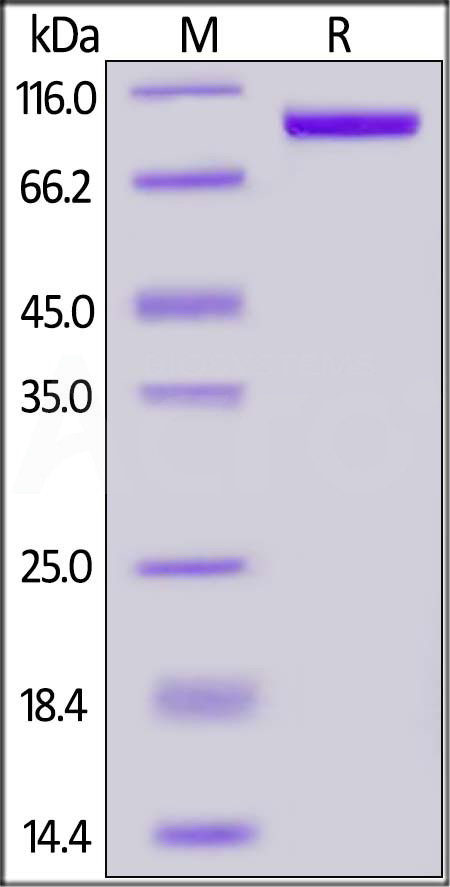 Mouse PSMA, His Tag (Cat. No. PSA-M5245) SDS-PAGE gel