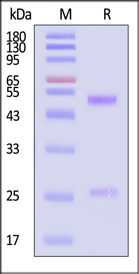 Rituximab SDS-PAGE