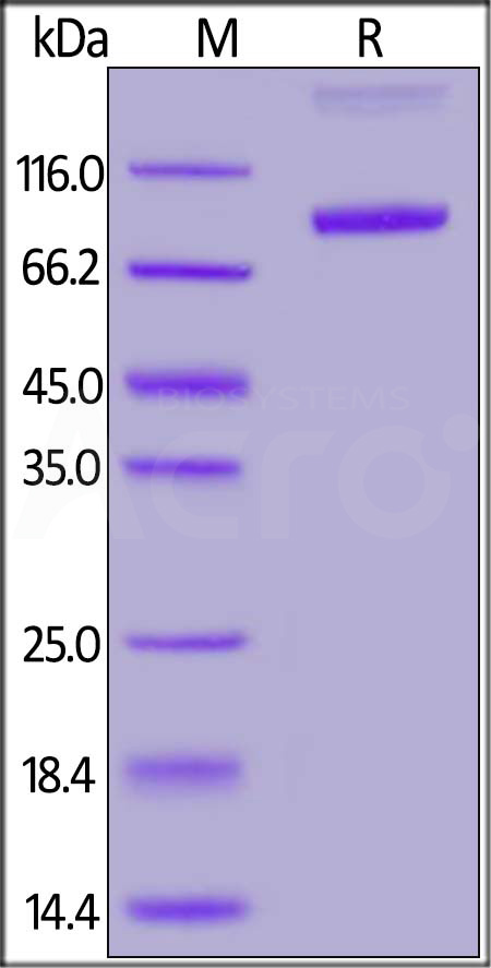 ROR1 SDS-PAGE