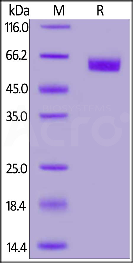 ROR1 SDS-PAGE