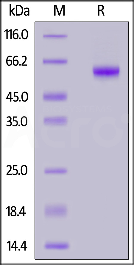 Mouse ROR1, His Tag (Cat. No. RO1-M5221) SDS-PAGE gel