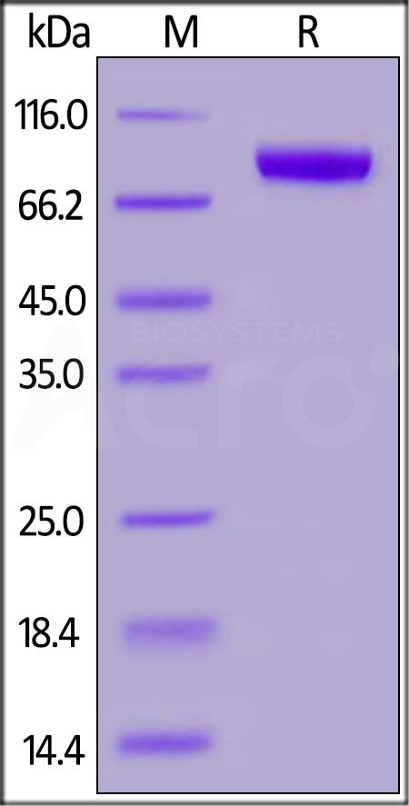 Mouse ROR1, Fc Tag (Cat. No. RO1-M5250) SDS-PAGE gel