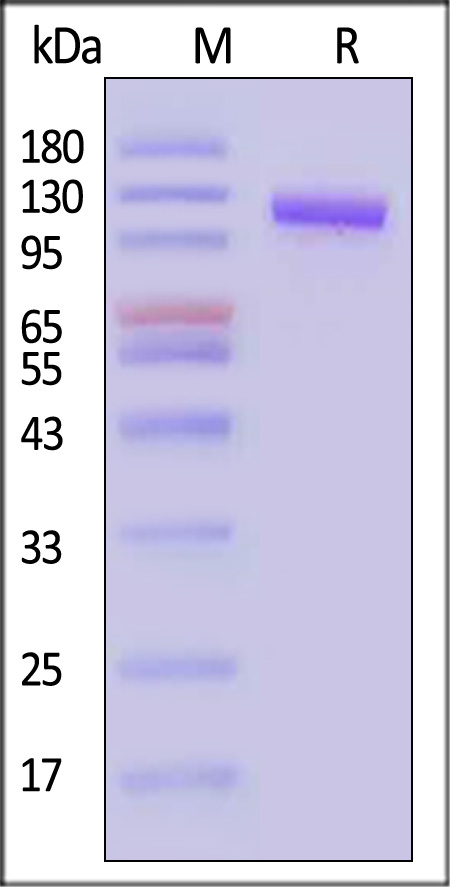 ROR1 SDS-PAGE