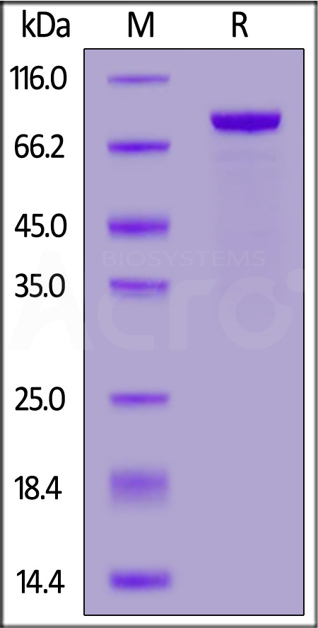 ROR2 SDS-PAGE