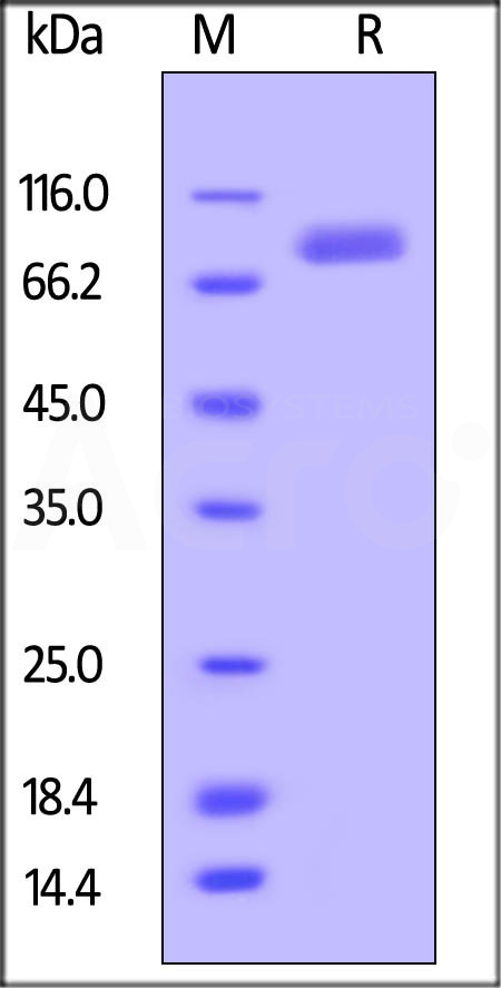 Mouse ROR2, Fc Tag (Cat. No. RO2-M5253) SDS-PAGE gel