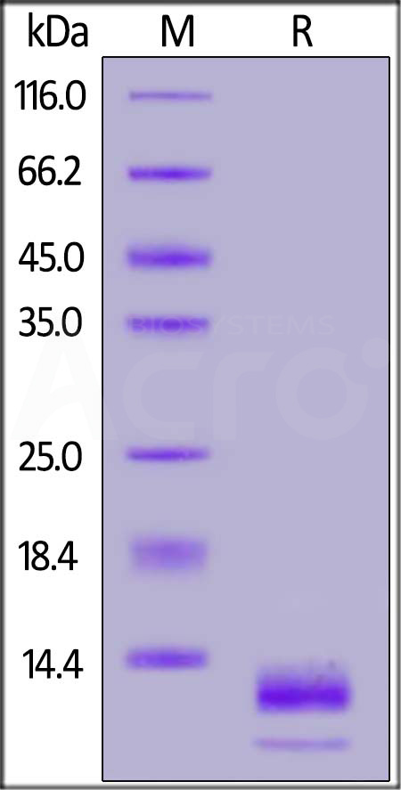 Human S100A14, His Tag (Cat. No. S14-H5121) SDS-PAGE gel