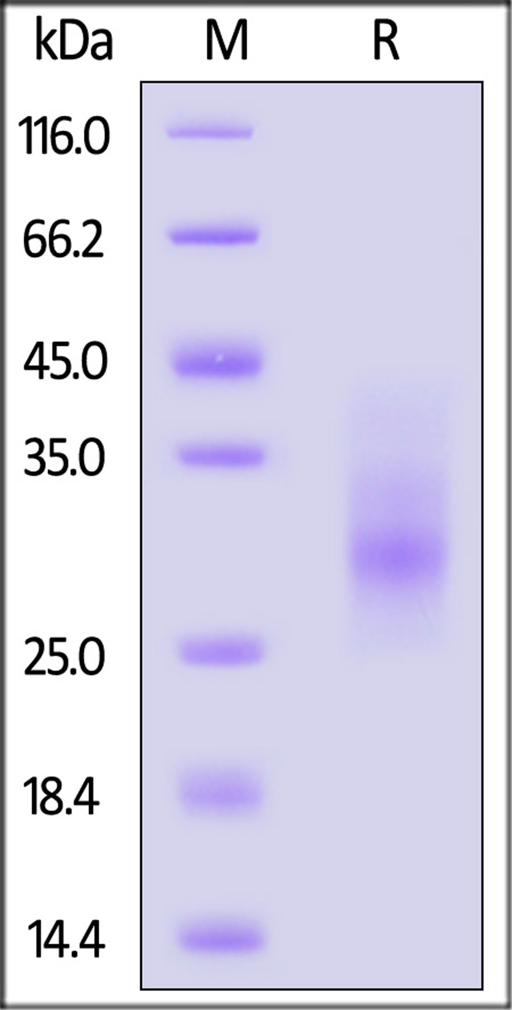 SCF SDS-PAGE