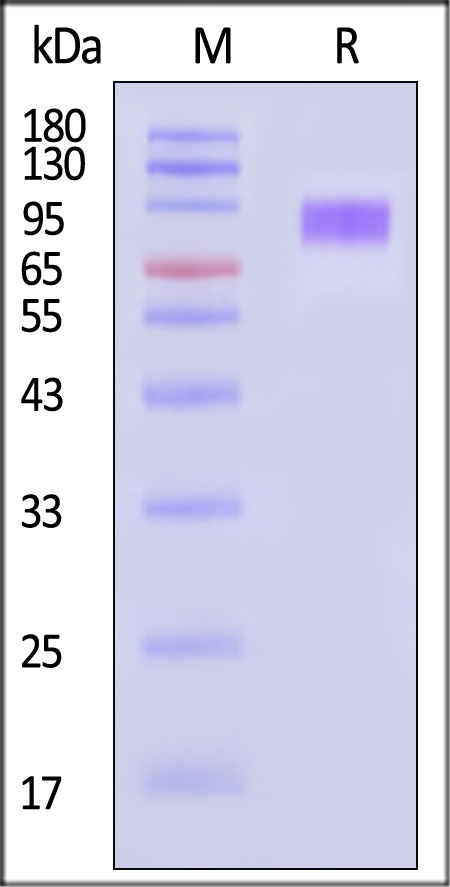 Serpin G1 SDS-PAGE