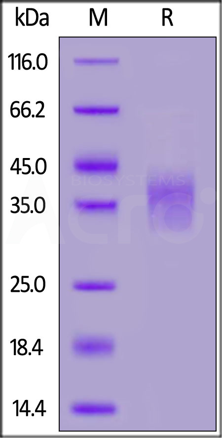 TGF-beta RII SDS-PAGE