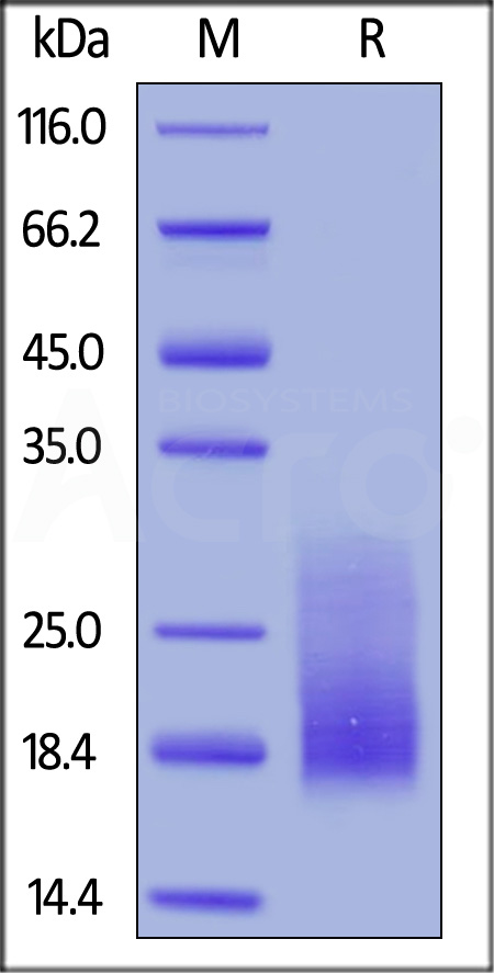 Cynomolgus / Rhesus macaque TIGIT, His Tag (Cat. No. TIT-C5223) SDS-PAGE gel