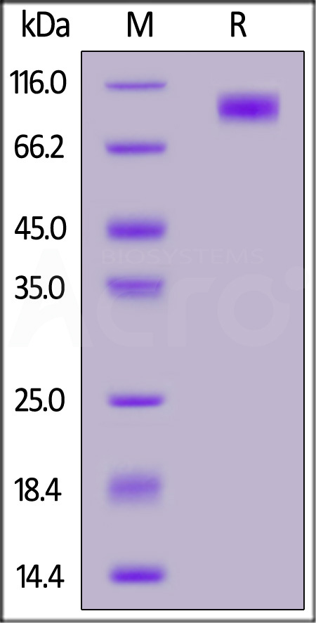 TPBG SDS-PAGE